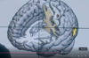 Capture normal.PNG