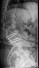 spine2.png